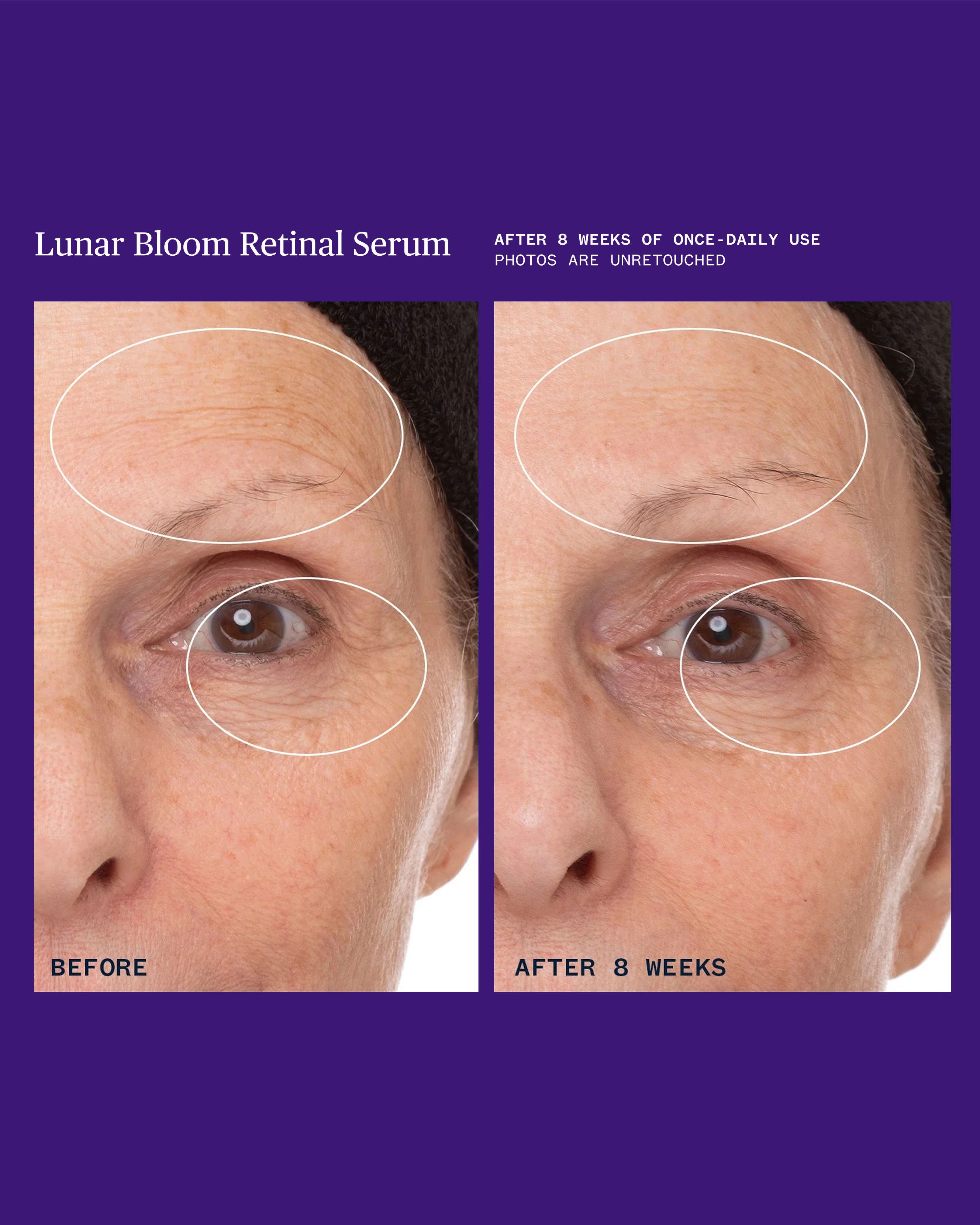 Ursa Major - Lunar Bloom Retinal Serum