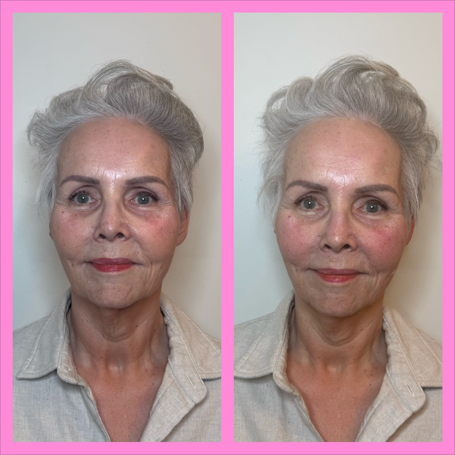 Buccal Massage
